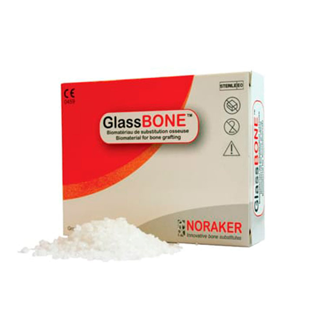 GlassBONE